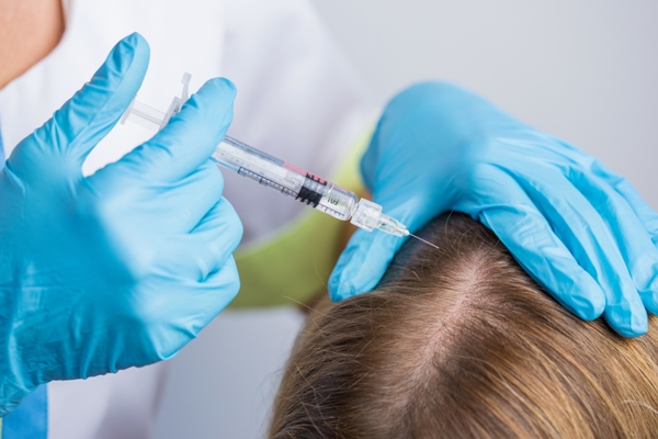 Mujer recibiendo tratamiento de trasplante de cabello