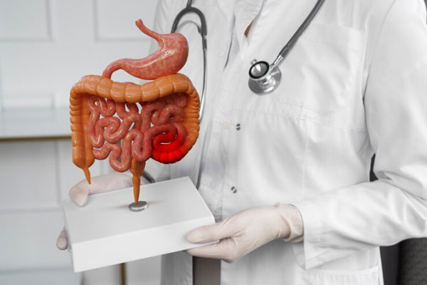 Doctor sostiene la figura de un tracto gastrointestinal con alteraciones severas en el colón