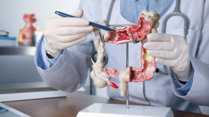 Gastroenterólogo en Madrid - Profesional de la salud con experiencia en trastornos digestivos señala una actividad irregular en un punto del colón para explicar las molestias que presenta un paciente