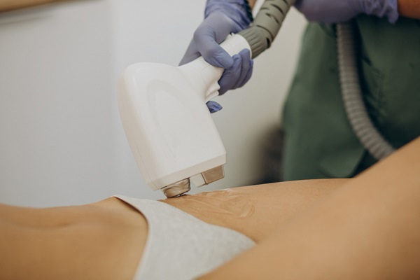 Tratamientos estéticos - Médico utilizando un dispositivo láser para tratamientos estéticos corporales en la mejor clínica estética Madrid
