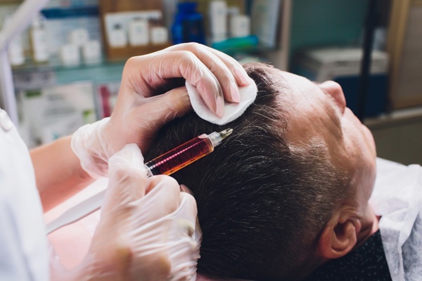 Soluciones para la alopecia - Tricólogo aplicando un tratamiento para la calvicie a un hombre con alopecia en las entradas